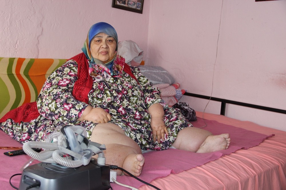 260 kilo ağırlığındaki kadın kilo verebilmek için yardım bekliyor
