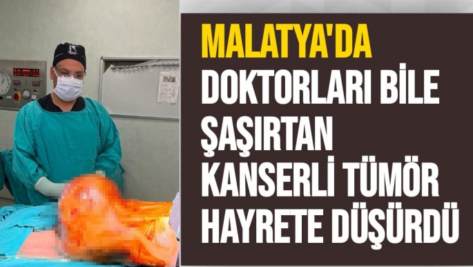 Malatya'da Doktorları bile şaşırtan kanserli tümör hayrete düşürdü