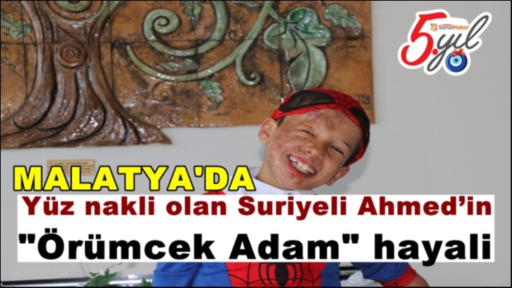 Malatya'da Yüz nakli olan Suriyeli Ahmed’in 